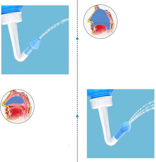 HOUDIAN Neti Pot nosní irigátor pro děti a dospělé, 2 nástavce, 300 ml
